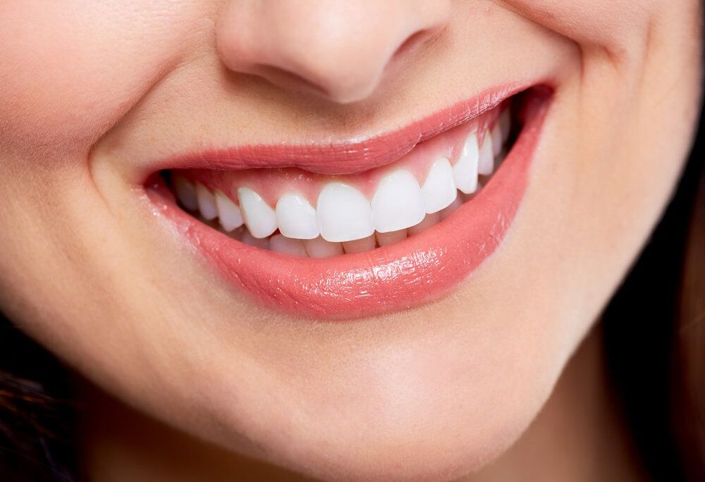 smile teeth treatment